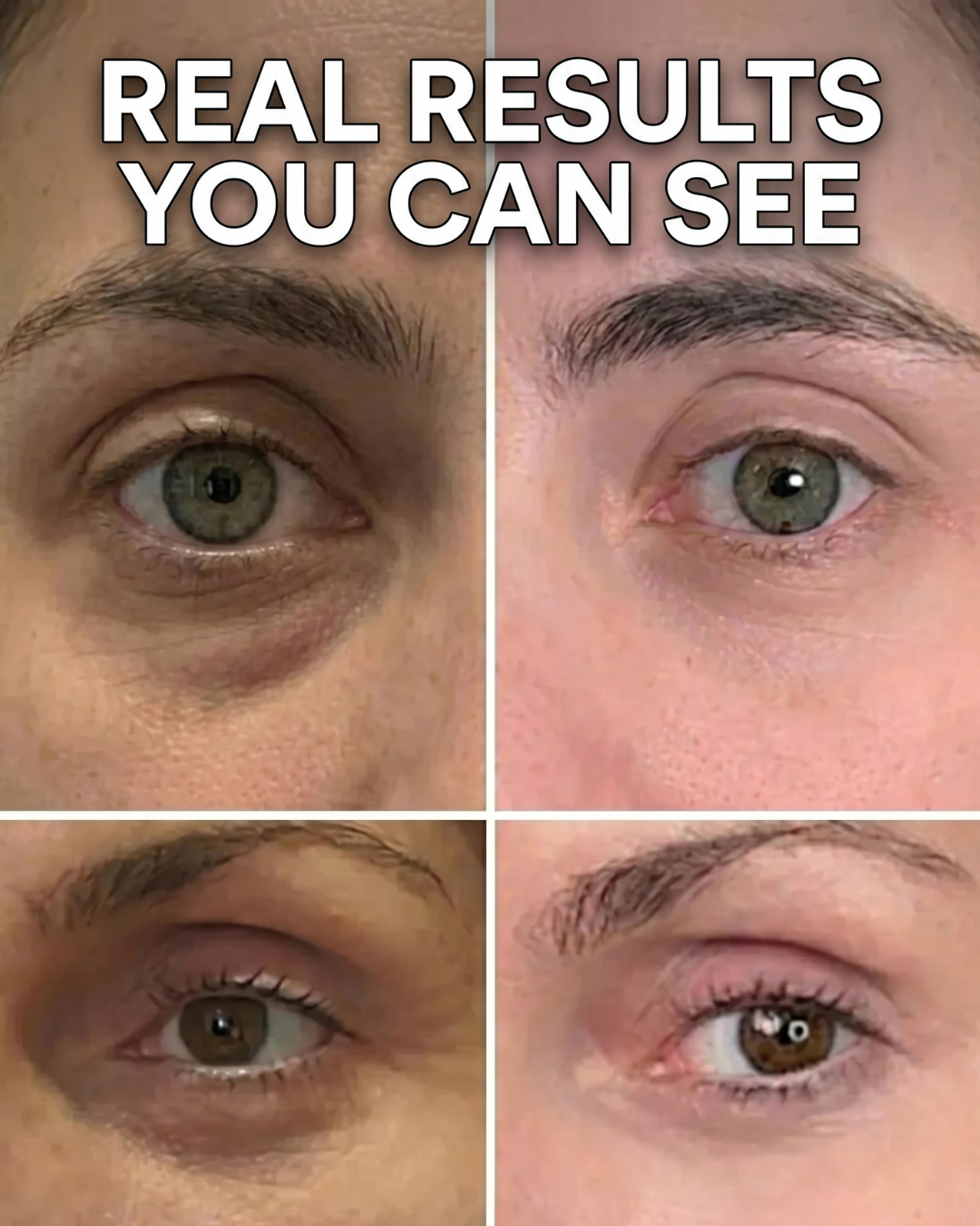 PDRN Bio-Collagen Lifting & Volume Stick