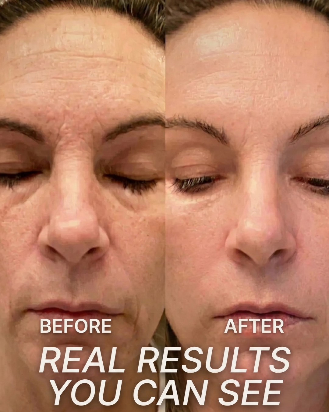 PDRN Bio-Collagen Lifting & Volume Stick