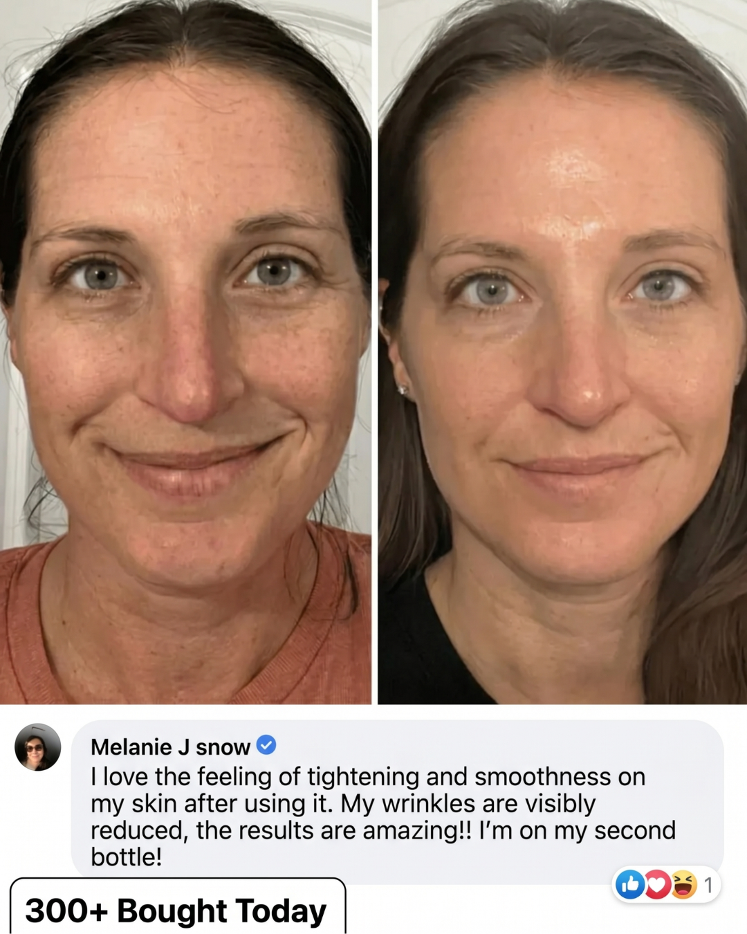 PDRN Bio-Collagen Lifting & Volume Stick