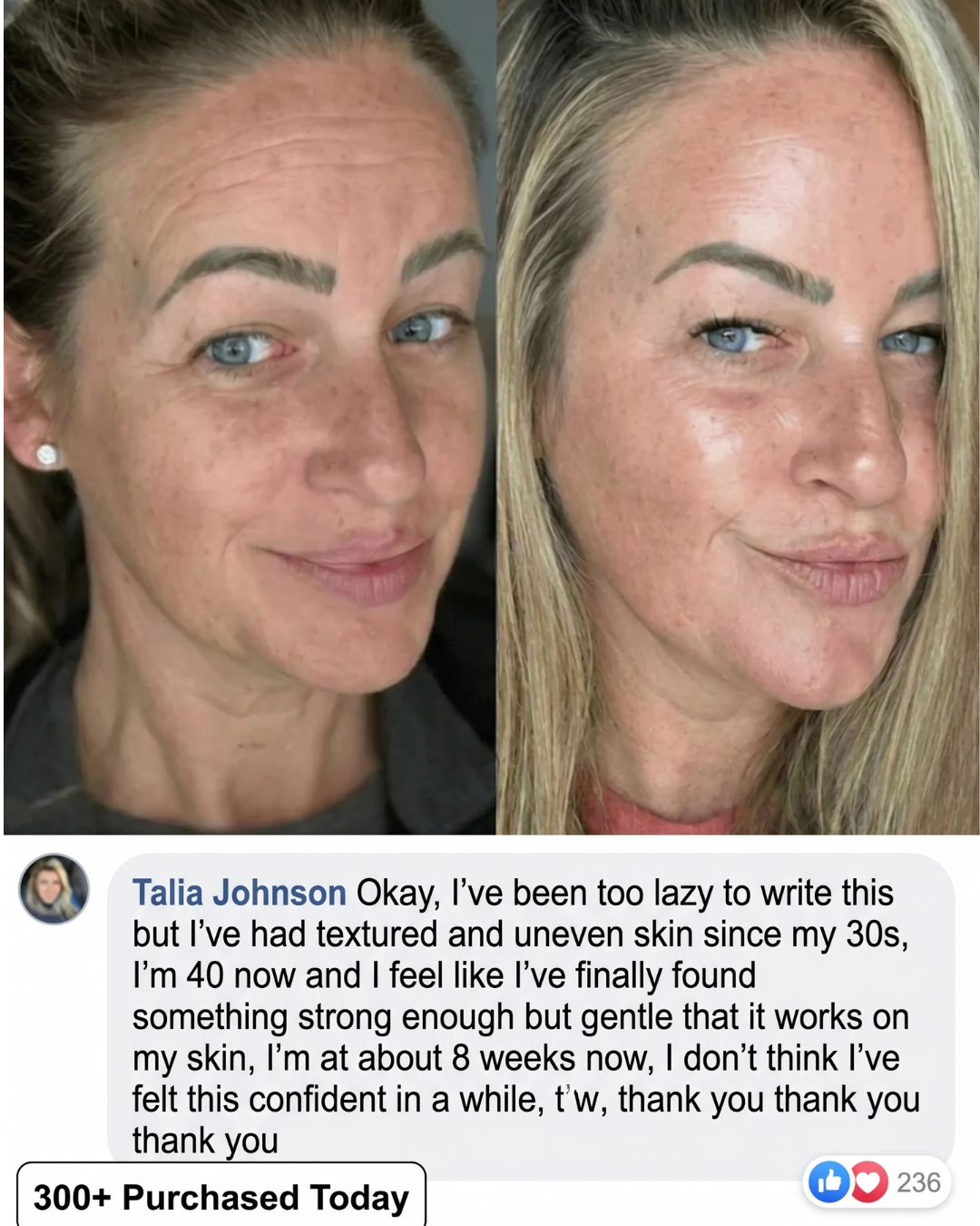 PDRN Bio-Collagen Lifting & Volume Stick