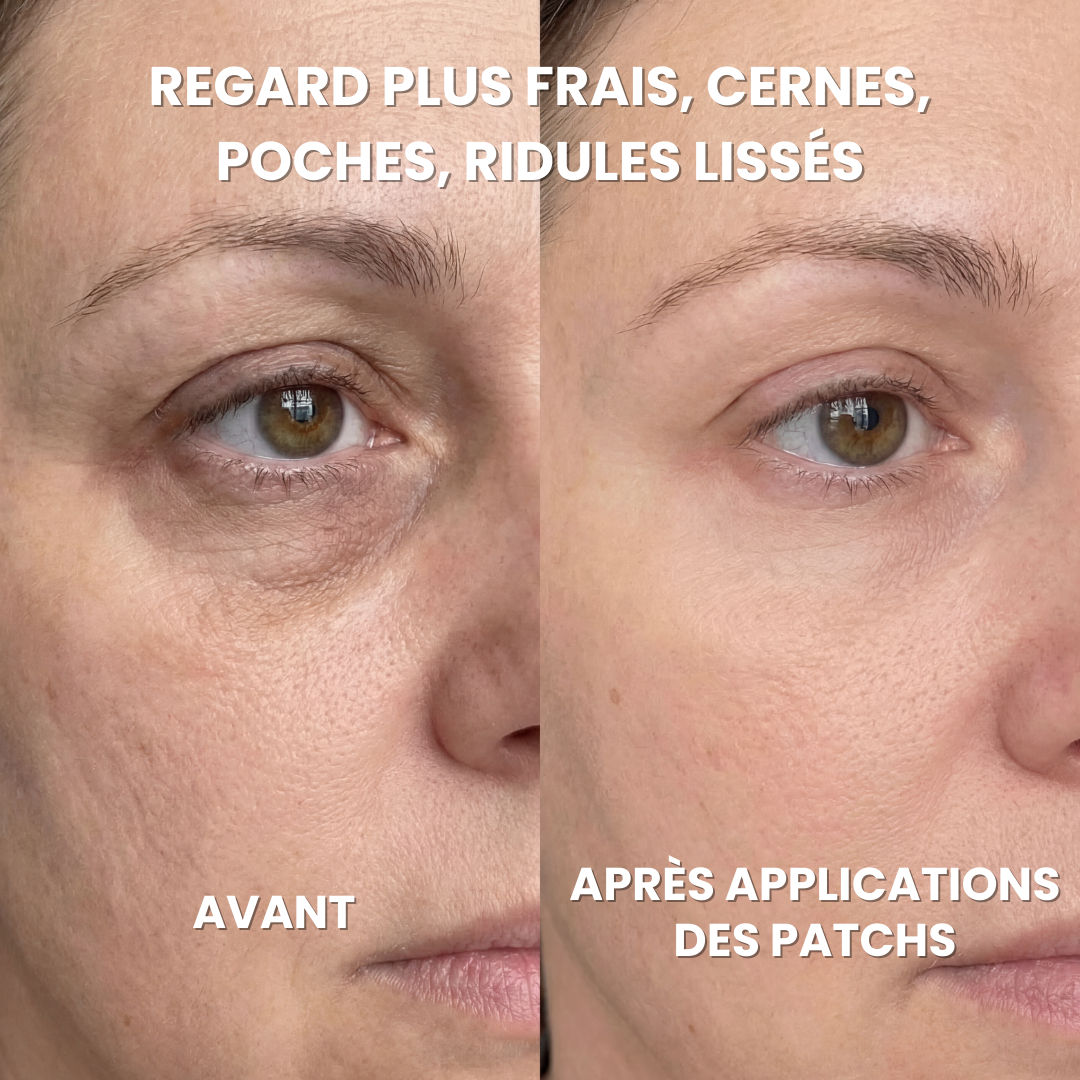 Hydrogel Anti-Dark Circle Patches - Caffeine, Collagen, Niacinamides