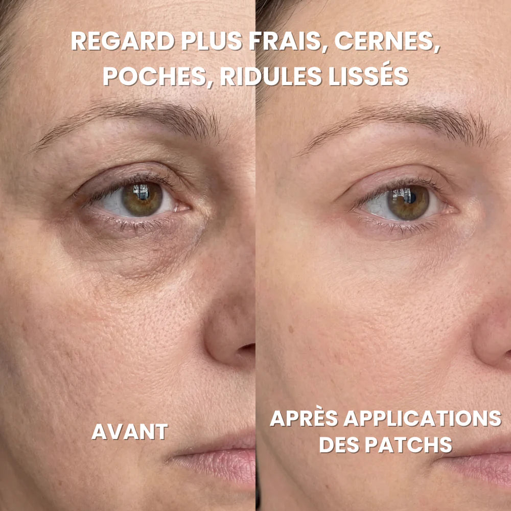 Hydrogel Dark Circle Patches - Caffeine, Collagen, Niacinamide